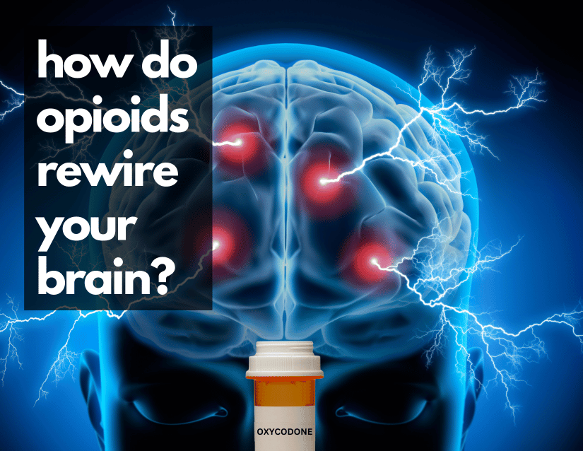 How do opioids rewire your brain?