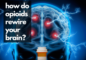 How do opioids rewire your brain?